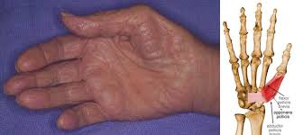 Image result for Hand Exam