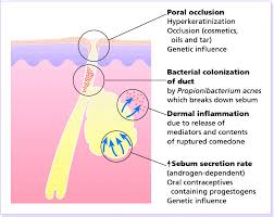 Image result for Dissotis glandulosa