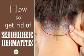 Although this is somewhat not harmful, it can be very irritating and disturbing. Pin On Category Is Face