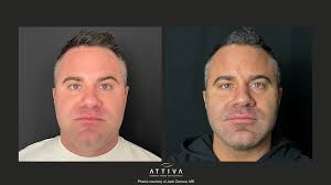 Jack Zamora MD Cosmetic Surgery and Aesthetics