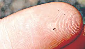 Image result for Chigger