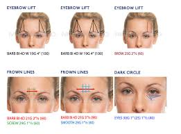 Beverly hills surgeon reveals at home fix for thinning eyebrows. Thread Lift San Francisco Medithread Pdo Thread Lift