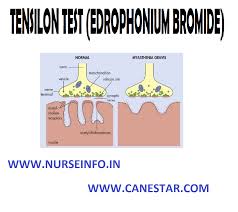 Image result for Tensilon Test