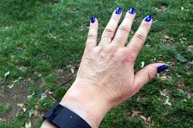 Why Hands And Fingers Swell When You Walk Or Run Swollen Hands Finger Hands Arthritis Remedies Hands