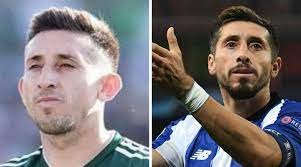 Ve los antes y después de pacientes que utilizaron doctores especialistas para encontrar al mejor cirujano plástico. Mira El Impactante Antes Y Despues De Hector Herrera Tras Cirugias La Neta Noticias