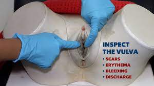 A cervical swab is required but referral to a sexual health clinic would be preferred. Vaginal Swabs Osce Guide Chlamydia Gonorrhoea Geeky Medics
