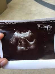 At women's health associates, we understand your needs, joys, and frustrations because we're women, too. Ika Lee S Life Update Pasal Baby