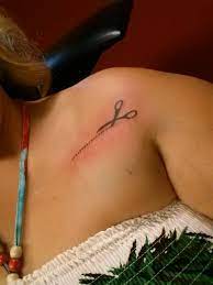 Piercings, pacemakers, tattoos may make you ineligible for an mri. Pacemaker Defibrillator Tattoo Ideas