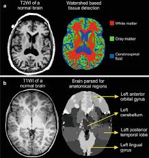 8 Automated Tissue Segmentation And Anatomical Brain Parsing A Download Scientific Diagram