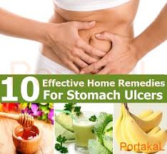 15 Natural Remedies For Common Health Issues Food For Stomach Ulcers Ulcer Diet Stomach Ulcers