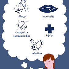 What Causes Swollen Lips