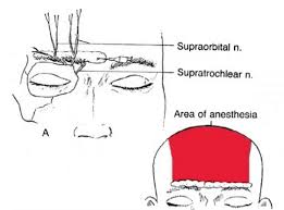 Image result for Forehead Regional Block