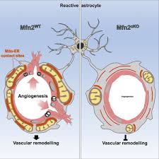 Eukaryotes house a distinct nucleus, a structure in which the genetic material (dna) is contained, surrounded by a membrane much like the outer cell membrane. Mitochondria Endoplasmic Reticulum Contacts In Reactive Astrocytes Promote Vascular Remodeling Sciencedirect