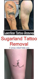 Read our home tattoo removal guide. How Quickly Can A Tattoo Be Removed Laser Tattoo Removal Near Me Best Laser Tattoo Removal Machine Tattoo Remova Tatowierungen Erstes Tattoo Tattooentfernung