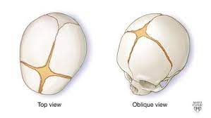 2} it is pulsating it is normal for the soft spot to pulsate with the heartbeat of the infant. Video Baby S Soft Spots Fontanels Mayo Clinic
