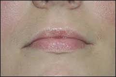 Image result for Lip Exam