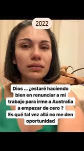 Sufres de productivitis? 🤔⁠ ⁠ 💚Sentarse en el pasto, ver el mar, o  simplemente ver pasar a las personas... cada cuanto lo haces? y cuando lo  haces sientes una incomodidad en tu