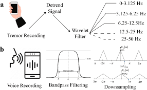 Image result for Rest Tremor
