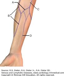 Image result for Peripheral IV Access