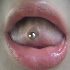 Zungenpiercing Entzundet Und Vereitert Was Tun Korper Schmerzen Piercing
