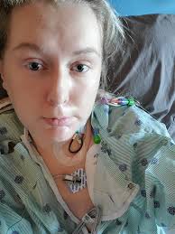 Pet adoption improves owner's health