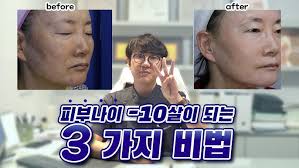 피부나이 -10살 어려지는 3가지 비법 !! [ 데이원의원 닥터월리 ]
