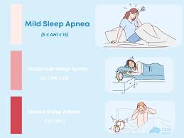 Image result for Sleep Apnea