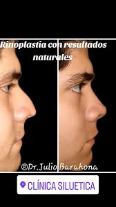 Cirujano Plástico Dr. Julio Barahona