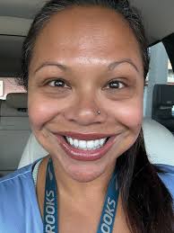 Syringomas. Im considering an upper bleph, but I have a lot of syringomas 