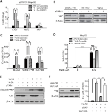 Chung chuan peter gan, died 2012. Nuclear Translocation And Activation Of Yap By Hypoxia Contributes To The Chemoresistance Of Sn38 In Hepatocellular Carcinoma Cells Abstract Europe Pmc
