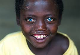 The ethiopian people's revolutionary democratic front (eprdf) defeated the derge, established democratic rule, and currently governs ethiopia. Abushe The Ethiopian Boy Bullied For His Beautiful Blue Eyes Travel Noire