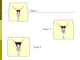 What it looks like hair on the penis may appear dark and coarse, like the pubic hair, or it may be soft and barely visible. What S Happening To Me A Guide To Your Body Ppt Video Online Download