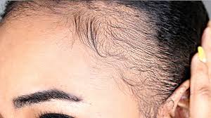 Discover the #1 most effective hair growth oil for healthy hair on the market, by experts. 7 Mistakes That Destroyed My Edges Natural Hair Grow Your Edges Back Fast Youtube