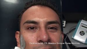 Utilización Electrodo facial electro estimulación