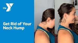 Name for hump.in back.of nevck. Get Rid Of Your Neck Hump Youtube