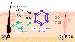毛根の死滅は発毛力の消滅 薄毛進行で髪は生えなくなるの 東京agaクリニック