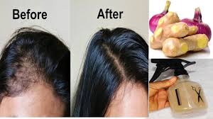 Over Night Hair Growth With Onion And Ginger Stop Hair Fall Youtube Night Hairstyles Ginger Hair Growth Hair Fall Remedy