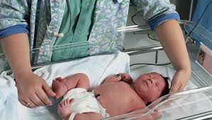 The cancer may also occur after a normal pregnancy. Infant Pain Heightened After Opioid Exposure In Womb Consumer Health News Healthday