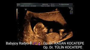 gebelikte ultrason 3 bolum bebek olcumleri kilosu boyu sivisi renkli