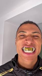 Mouthguard Delivery for Chase Ahead of Misfits Boxing Fight