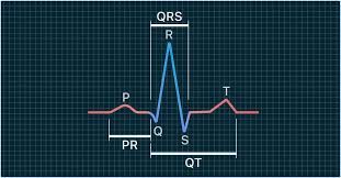 Image result for QRS Complex