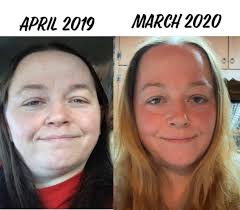 Lisa Berry Shelton asked me to share my story and here is the best before  and after pictures I could fine. I am usually behind the camera. I have  struggled with my