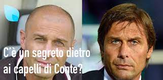 Troppo facile parlare col sorriso quando si vince. Conte Trapianto Capelli Il Segreto Nascosto Del Mister Hairclinic