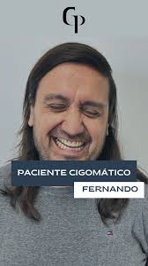 Compartimos algunos de las imágenes 📷que muestran lo que se vivió en la  Jornada de Actualización en Cirugía Oral y Maxilofacial en el Centro  Universitario Chivilcoy 🎓, Buenos Aires. . . Este