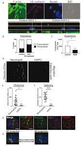In this article, we discuss the doctors categorize bone marrow cancer according to the type of cell that it affects. Hematopoietic Stem And Progenitor Cells Use Podosomes To Transcellularly Cross The Bone Marrow Endothelium Haematologica