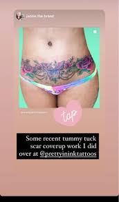 Maybe you would like to learn more about one of these? How Much Is A Tummy Tuck Dr Miami