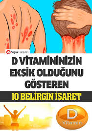 10 Erkennungsmerkmale Fur Vitamin D Mangel Erkennungsmerkmale Gesundheit Mangel Vitamin Vitamin D Beauty Tipps Tipps