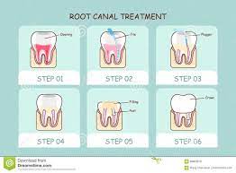 Pin By Laxmy On My Dream Dental Clinic Dental Cosmetic Dental Clinic Root Canal