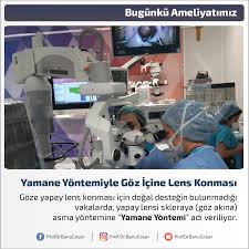 Goze Yapay Lens Konmasi Icin Dogal Destegin Bulunmadigi Vakalarda Yapay Lensi Skleraya Goz Akina Asma Yontemine Yamane Yontemi Adi Veril Dogal Adlar Bilgi