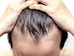 A derma roller helps to regrow your lose hair and boosts new hair growth. Hair Loss After Surgery How To Grow Your Hair Back Lewigs